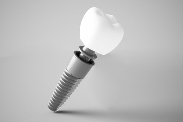 implant-2-websitesi